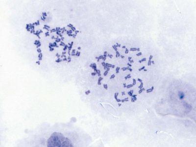 Brightfield Chromosome Specimen11